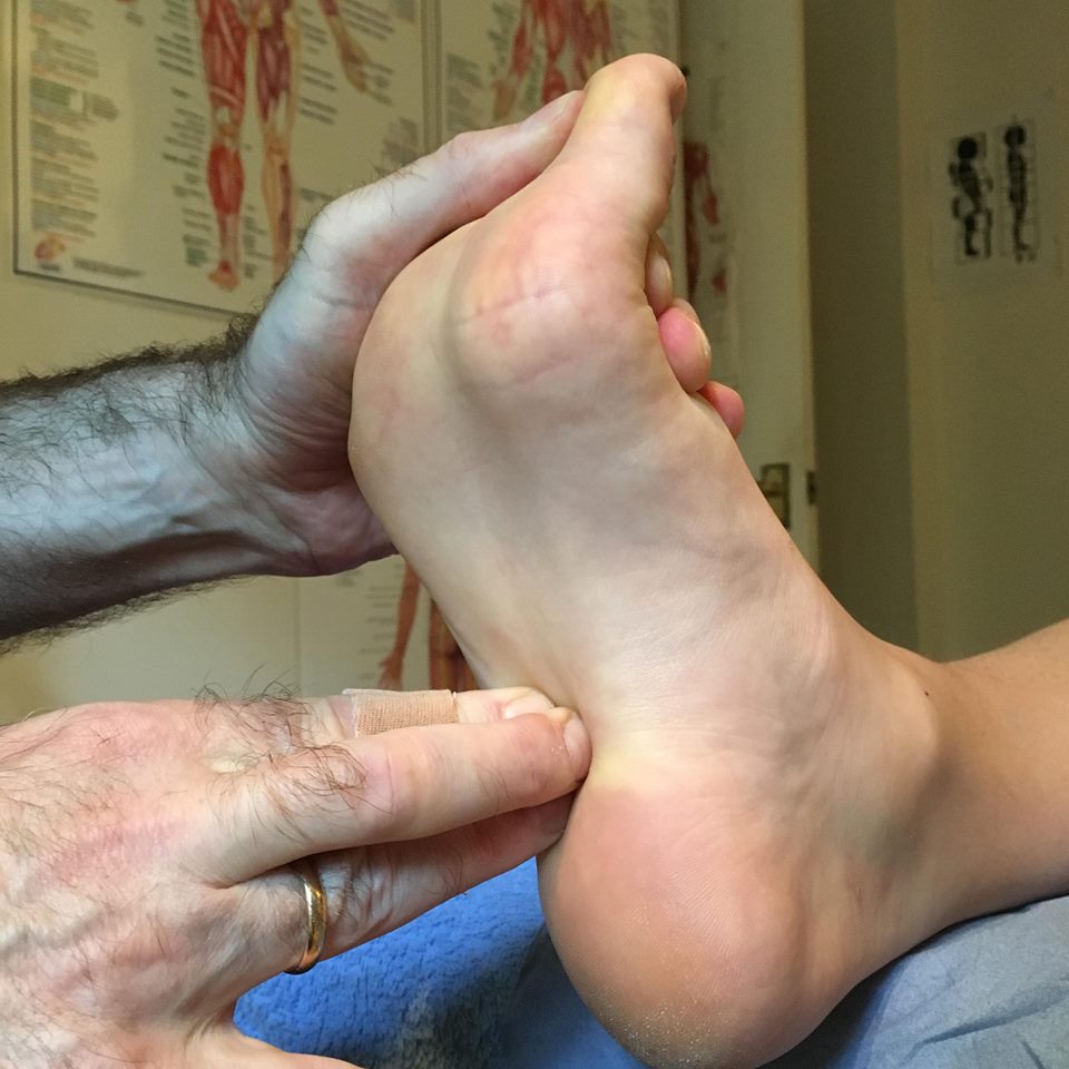 Rolfing Plantar fascia release